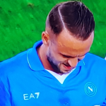 Anche Lobotka è out !