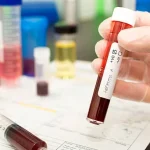 Caso di epatite A in una scuola del Casertano, le autorità: nessun allarmismo